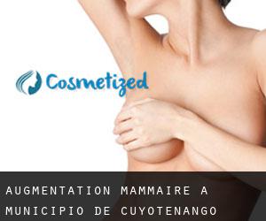Augmentation mammaire à Municipio de Cuyotenango