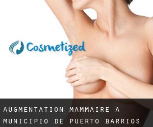 Augmentation mammaire à Municipio de Puerto Barrios