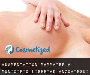 Augmentation mammaire à Municipio Libertad (Anzoátegui)