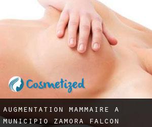 Augmentation mammaire à Municipio Zamora (Falcón)