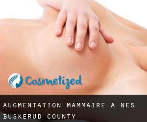 Augmentation mammaire à Nes (Buskerud county)