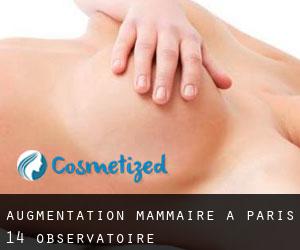 Augmentation mammaire à Paris 14 Observatoire
