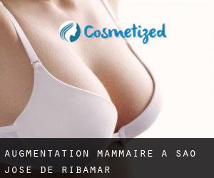 Augmentation mammaire à São José de Ribamar
