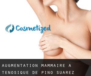 Augmentation mammaire à Tenosique de Pino Suárez
