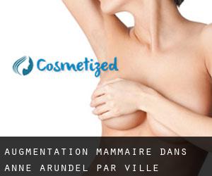 Augmentation mammaire dans Anne Arundel par ville importante - page 1