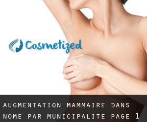 Augmentation mammaire dans Nome par municipalité - page 1