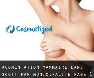 Augmentation mammaire dans Scott par municipalité - page 1