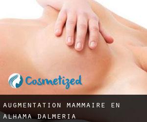 Augmentation mammaire en Alhama d'Almería