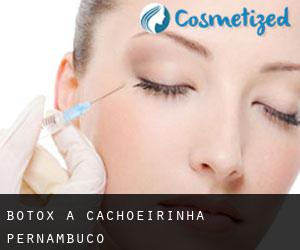 Botox à Cachoeirinha (Pernambuco)