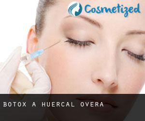 Botox à Huercal Overa Botox à Huercal Overa