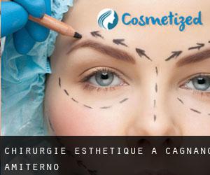 Chirurgie Esthétique à Cagnano Amiterno