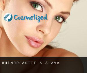 Rhinoplastie à Alava