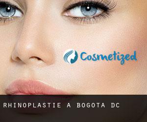 Rhinoplastie à Bogota D.C. Rhinoplastie à Bogota D.C.
