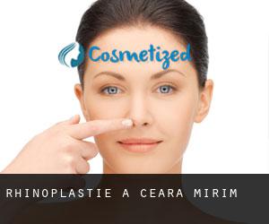 Rhinoplastie à Ceará-Mirim