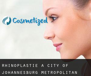 Rhinoplastie à City of Johannesburg Metropolitan Municipality
