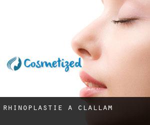 Rhinoplastie à Clallam Rhinoplastie à Clallam