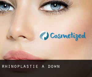 Rhinoplastie à Down Rhinoplastie à Down