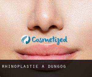 Rhinoplastie à Dungog Rhinoplastie à Dungog
