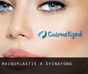 Rhinoplastie à Evinayong Rhinoplastie à Evinayong