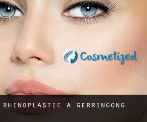 Rhinoplastie à Gerringong Rhinoplastie à Gerringong
