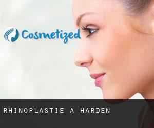 Rhinoplastie à Harden Rhinoplastie à Harden