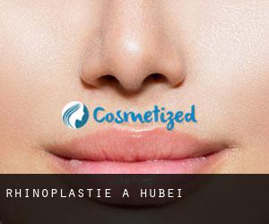 Rhinoplastie à Hubei Rhinoplastie à Hubei