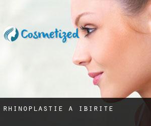 Rhinoplastie à Ibirité