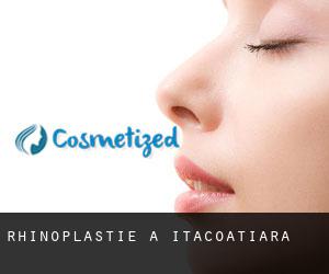 Rhinoplastie à Itacoatiara