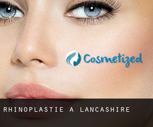 Rhinoplastie à Lancashire