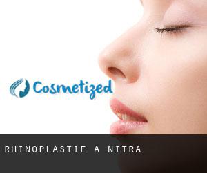 Rhinoplastie à Nitra Rhinoplastie à Nitra