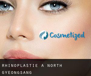 Rhinoplastie à North Gyeongsang Rhinoplastie à North Gyeongsang