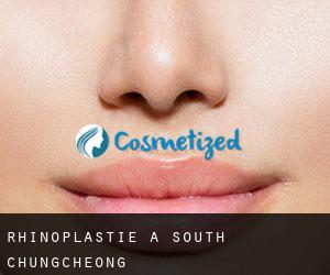 Rhinoplastie à South Chungcheong Rhinoplastie à South Chungcheong