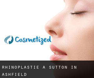 Rhinoplastie à Sutton in Ashfield Rhinoplastie à Sutton in Ashfield