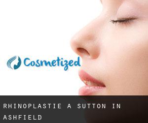 Rhinoplastie à Sutton in Ashfield