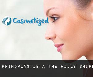 Rhinoplastie à The Hills Shire Rhinoplastie à The Hills Shire