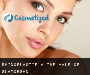 Rhinoplastie à The Vale of Glamorgan Rhinoplastie à The Vale of Glamorgan
