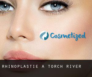 Rhinoplastie à Torch River Rhinoplastie à Torch River
