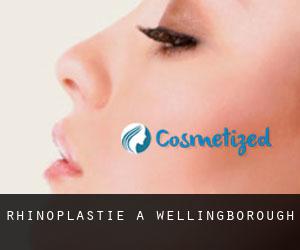 Rhinoplastie à Wellingborough Rhinoplastie à Wellingborough