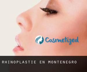 Rhinoplastie en Monténégro