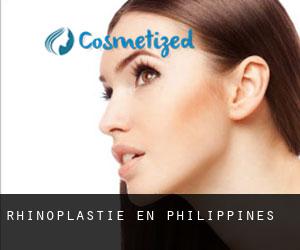 Rhinoplastie en Philippines Rhinoplastie en Philippines