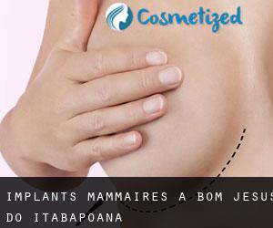 Implants mammaires à Bom Jesus do Itabapoana