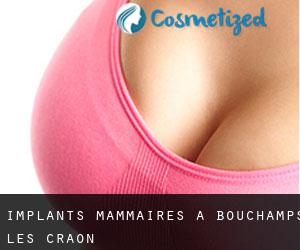 Implants mammaires à Bouchamps-lès-Craon