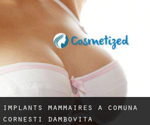 Implants mammaires à Comuna Corneşti (Dâmboviţa)