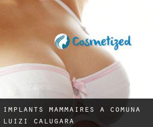 Implants mammaires à Comuna Luizi-Cãlugãra