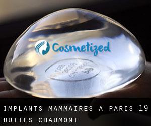 Implants mammaires à Paris 19 Buttes-Chaumont