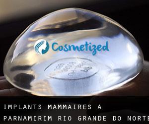 Implants mammaires à Parnamirim (Rio Grande do Norte)