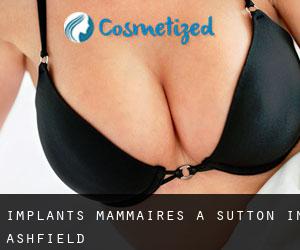Implants mammaires à Sutton in Ashfield Implants mammaires à Sutton in Ashfield