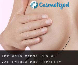 Implants mammaires à Vallentuna Municipality