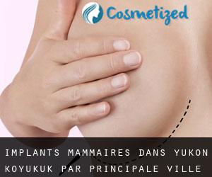 Implants mammaires dans Yukon-Koyukuk par principale ville - page 2