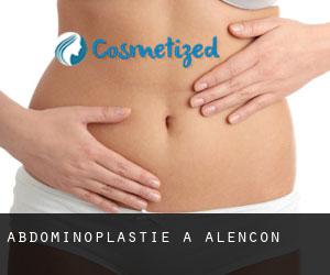 Abdominoplastie à Alençon